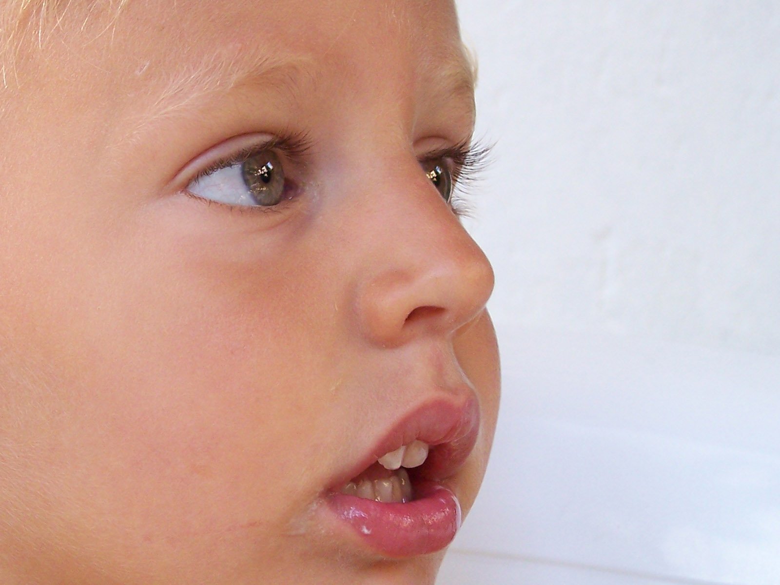 Дыхание открытым ртом. Аденоидный Тип лица у детей.